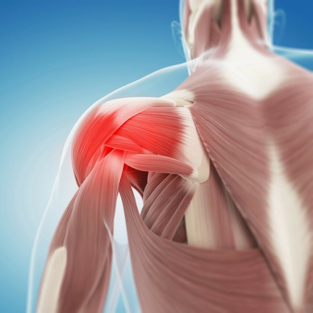 [Image: Shoulder-pain-image-1024x1024.jpg]